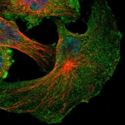 NF2/Merlin Antibody, Novus Biologicals:Antibodies:Primary Antibodies